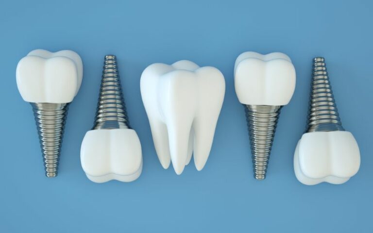Dental implants lined up next to each other